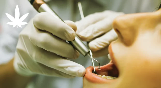 O uso da cannabis na odontologia: benefícios, aplicações e evidências